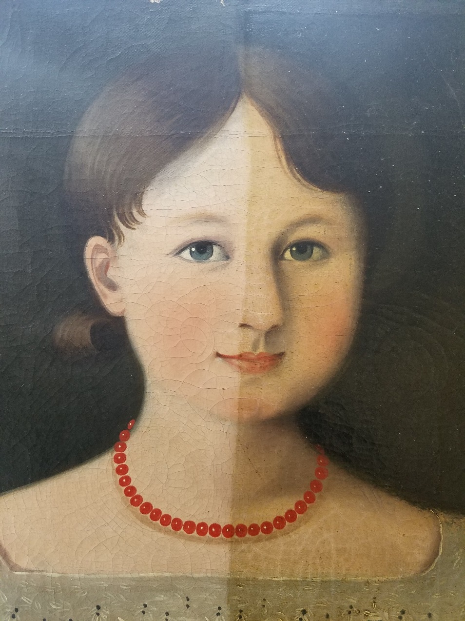 Detail shot showing varnish removed from half of the painting Painting of girl's face with paint on left side lighter and less yellowed than on right side